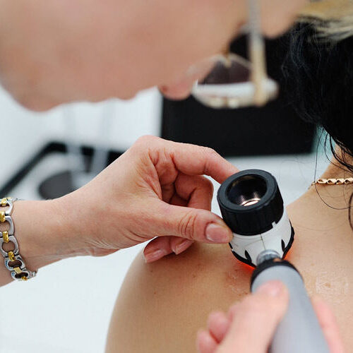 observación de una mancha